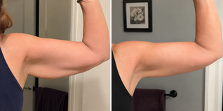 Slimova™ DermaTherm Arm Sleeve